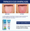 EELHOE - Tongue Cleansing Gel Trendy zone